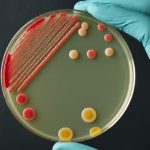 Understanding the Importance of Microbiological Food Sampling