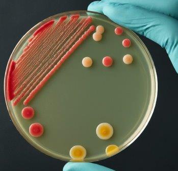 Understanding the Importance of Microbiological Food Sampling